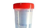 COLECTOR TIPO "ORINA" 100 ML ASEPTICO